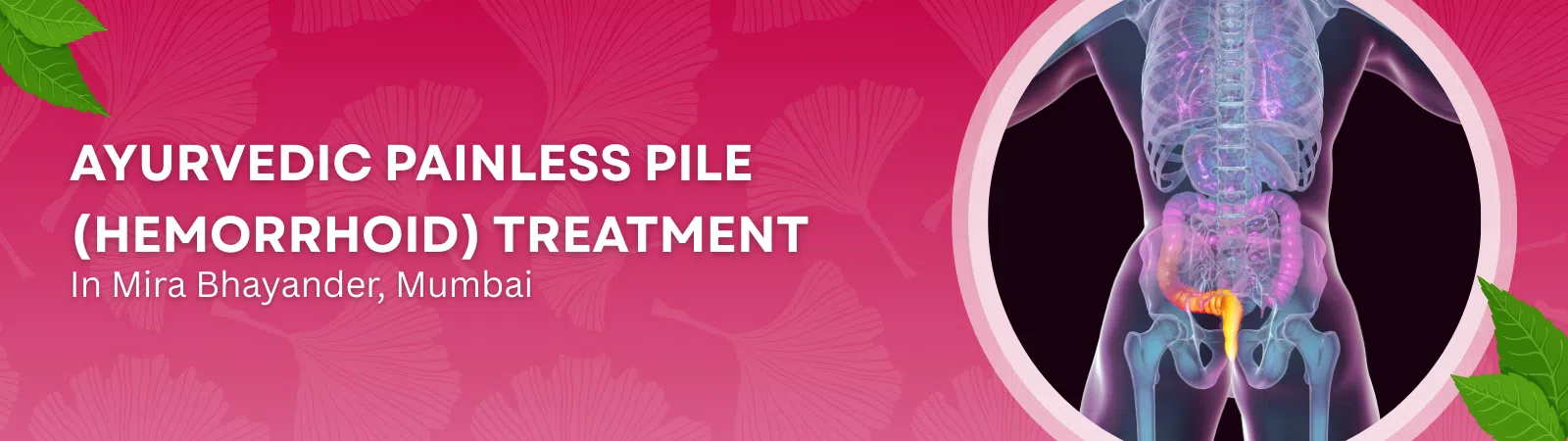 Ayurvedic Painless pile Hemorrhoid treatment banner